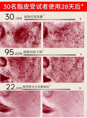 威格菲天然植物卸妆敏感肌脸部