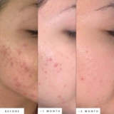 50 мл большая бутылка!Травоядное масло из травоядных синий эссенсин.