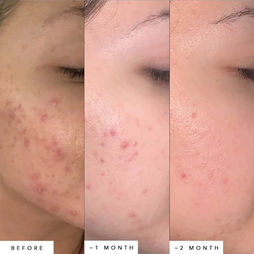 50 мл большая бутылка!Травоядное масло из травоядных синий эссенсин.