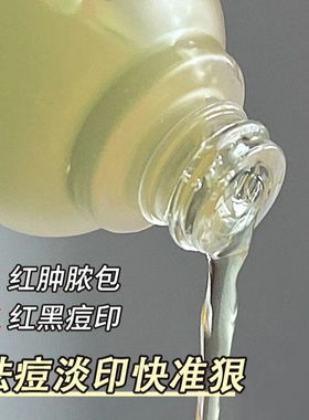 hfp祛痘淡印精华液去淡化痘印淡斑美白修护舒缓控油寡肽原液男女