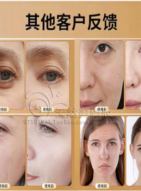 男女去皱纹抗衰老提拉紧致护肤品