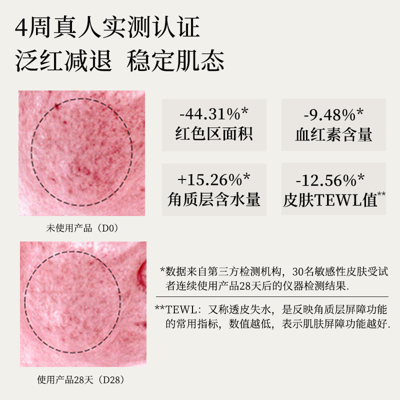 寻荟记三重修护芦荟精华水补水保湿爽肤水舒缓泛红维稳化妆湿敷水-图1