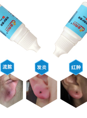 耳洞发炎流脓护理消毒棒