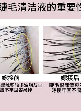 睫毛清洁液嫁接睫毛专用深层去油