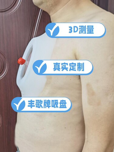 青岛丰歌漏斗胸矫正器矫形负压吸盘少年款中国专利原创厂家直销 - 图0