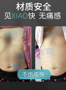 儿童成人胸部体态矫形漏斗胸吸盘