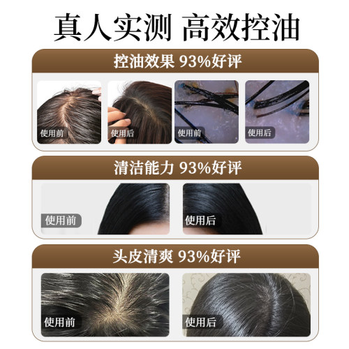 章光101控油无患子洗发水扁塌男士洗发水 - 图0