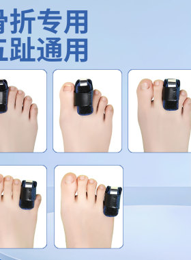 大脚趾骨折固定器脚趾头足趾拇趾足部固定支具保护套扭伤夹板支撑