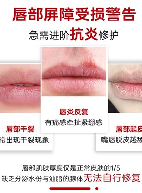 粉茉B5唇部精华修复唇炎维稳