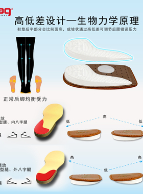pedag德国xo型腿半码垫后跟垫