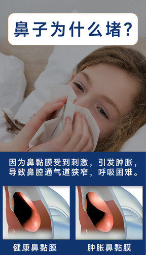 正品鼻域通乐儿童喷剂儿童鼻干痒鼻堵零激素鼻通气鼻子不通喷剂 - 图1