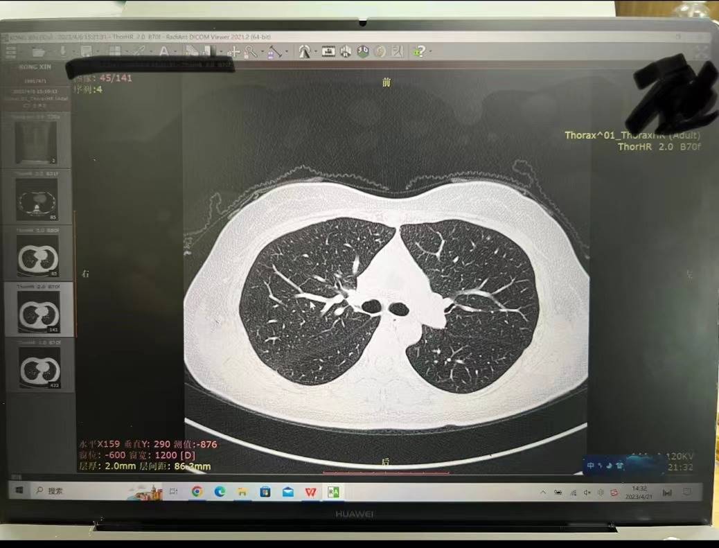 radiant dicom viewer软件远程安装 2021.2.2免注册医学影像重建-图0