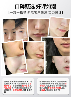 氐殊三文鱼婴儿针舒缓修复补水