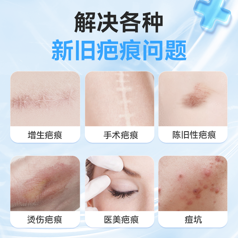 维德医用硅酮疤痕凝胶敷料修复增生凸起淡化剖腹产儿童祛疤膏官方
