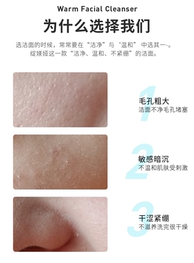 绽媄娅干净不紧绷痘痘肌洁面泡沫