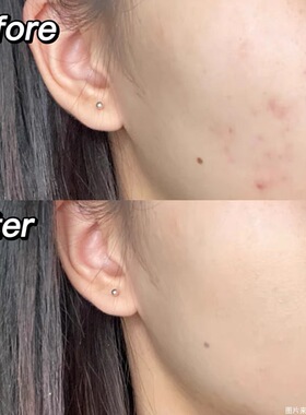 nars娜斯遮瑕膏遮脸部黑眼圈斑点