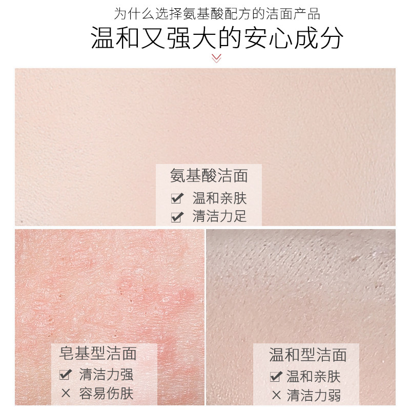 康芙美清痘洁面泡沫清洁去油洗面奶 康芙美洁面