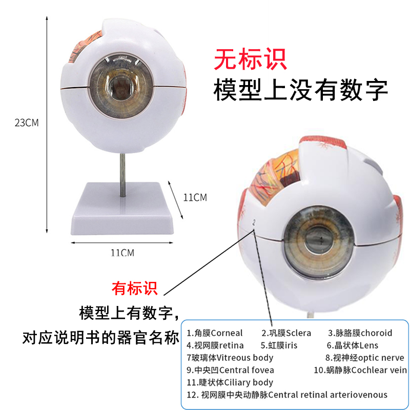 人体眼球模型 6倍放大眼球模型 五官科眼睛构造解剖教学模型 医学 - 图2