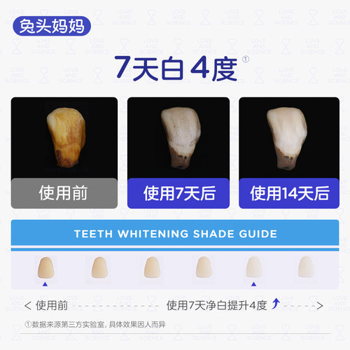 兔头妈妈儿童牙膏高纯奥拉氟双效健白牙膏防蛀牙龋齿3-6-12岁含氟 - 图2