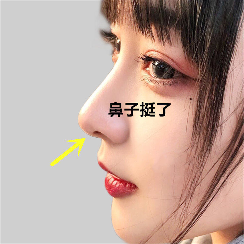 【挺出你的新高度】美鼻抹出自然精油 bidailanka单方精油