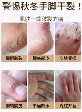 润面油保湿滋润防干裂柔润防脱皮
