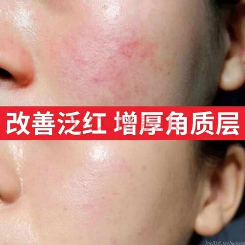 北京邦定美肤霜升级款敏姬赋活美颜修护霜100g柔润型角质层敏感肌 - 图1