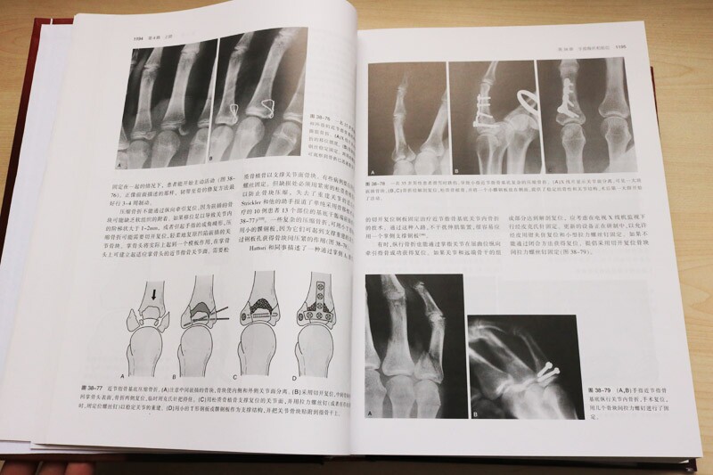 创伤骨科学卷骨骼肌肉损伤实用参考书籍从业医师实习医师专业知识 布鲁斯D布朗纳,杰西B朱庇特,艾伦M 天津科技翻译出版公司