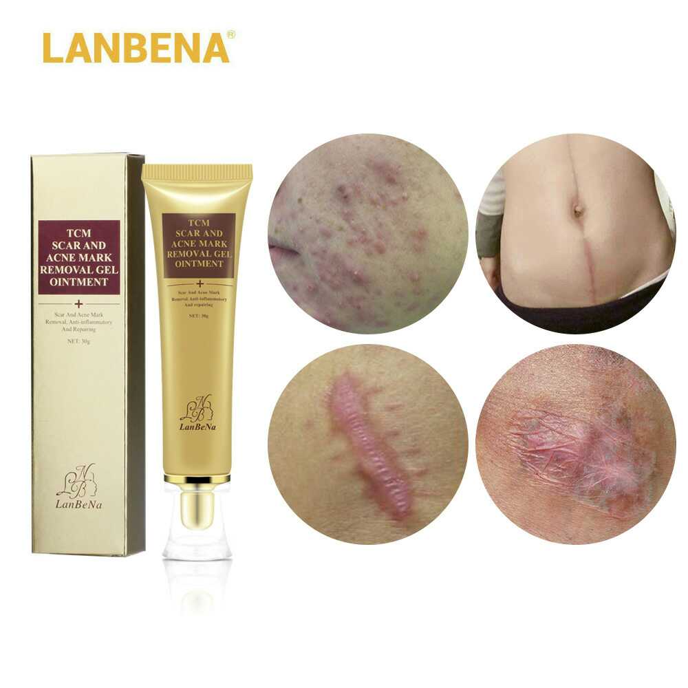 LANBENA 蓝蓓娜TCM SCAR AND ACNE MARK REMOVAL GEL 修复膏 - 图0