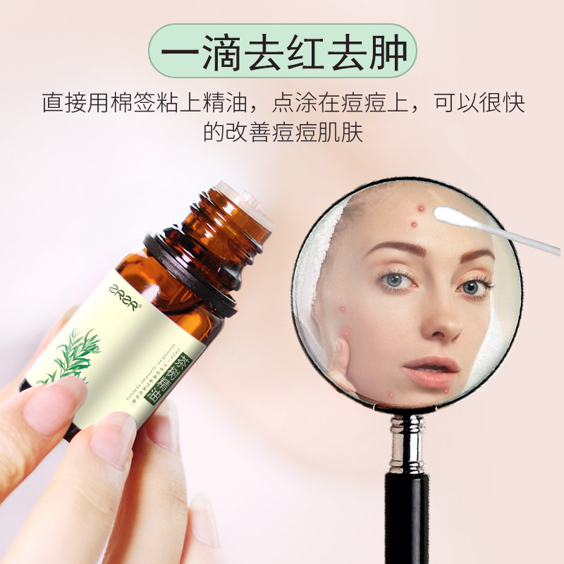 澳洲茶树10ml面部祛控油消菌茶树油 zrzr单方精油