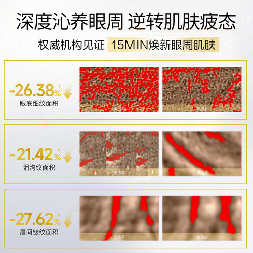 【U先派样】阿芙面眼组合胶囊精华去黄提亮4粒Y - 图3