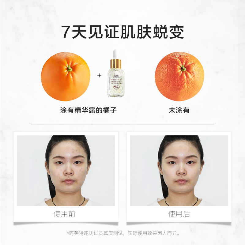 阿芙官方旗舰店阿芙马鞭草酮迷迭香精华露 马迷精华液面部精华收缩毛孔粗大修护2