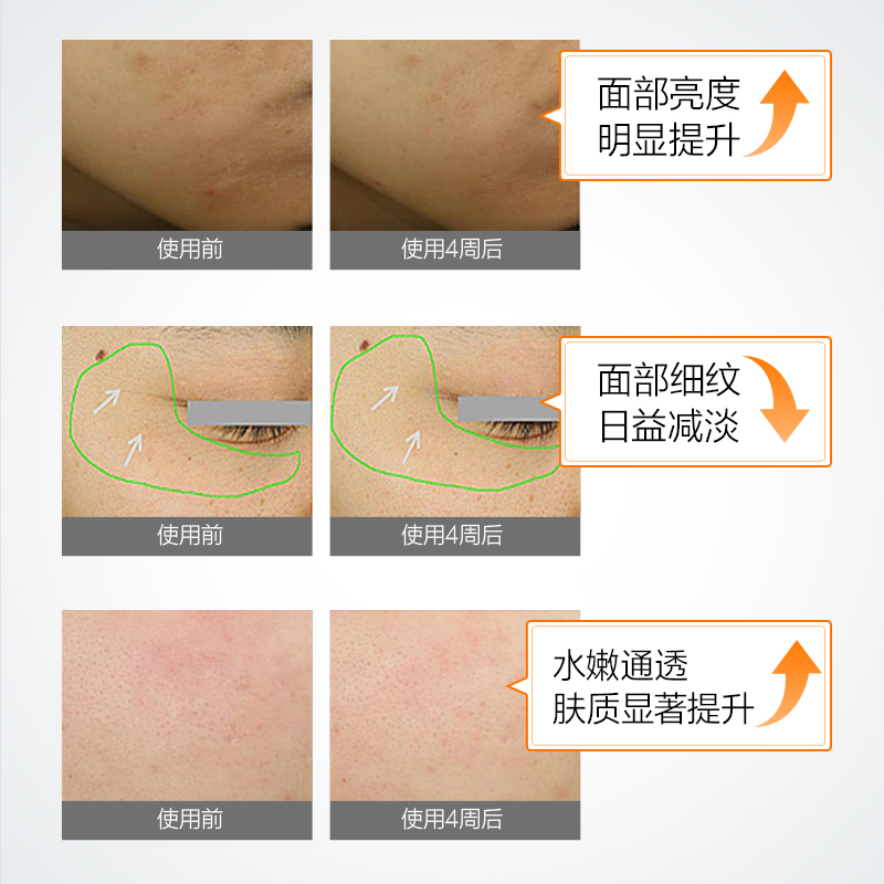 蔡徐坤同款珀莱雅双抗精华液肌肽虾青素抗糖化抗氧化抗初老精华女 蔡徐坤同款珀莱雅双抗精华液肌肽虾青素抗糖化抗氧化抗初老精华女