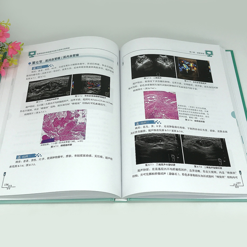 正版包邮 浅表软组织疾病超声诊断与病理对照图谱 刘勋 魏玺 临床医学 超声学书籍 9787518973743 科学技术文献出版社 - 图3