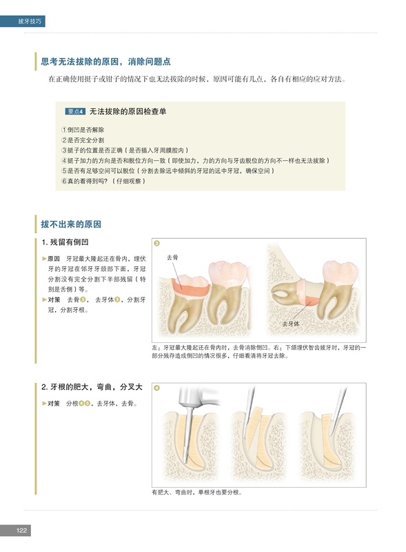 正版包邮 拔牙技巧 必成高手 口腔医学书籍 咬合 拔牙方法手法麻醉处置应对 手术图谱微创技巧 正畸经典病例解析 牙科医生参考 - 图3