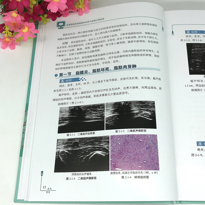 正版包邮 浅表软组织疾病超声诊断与病理对照图谱 刘勋 魏玺 临床医学 超声学书籍 9787518973743 科学技术文献出版社 - 图1