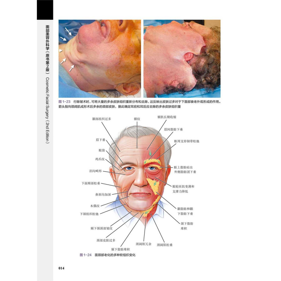 面部美容外科学 原书第2版 乔 尼亚姆图三世著 引进版西医医学书精装大部头美容外科学医学读物 中国科学技术出版社97875046877