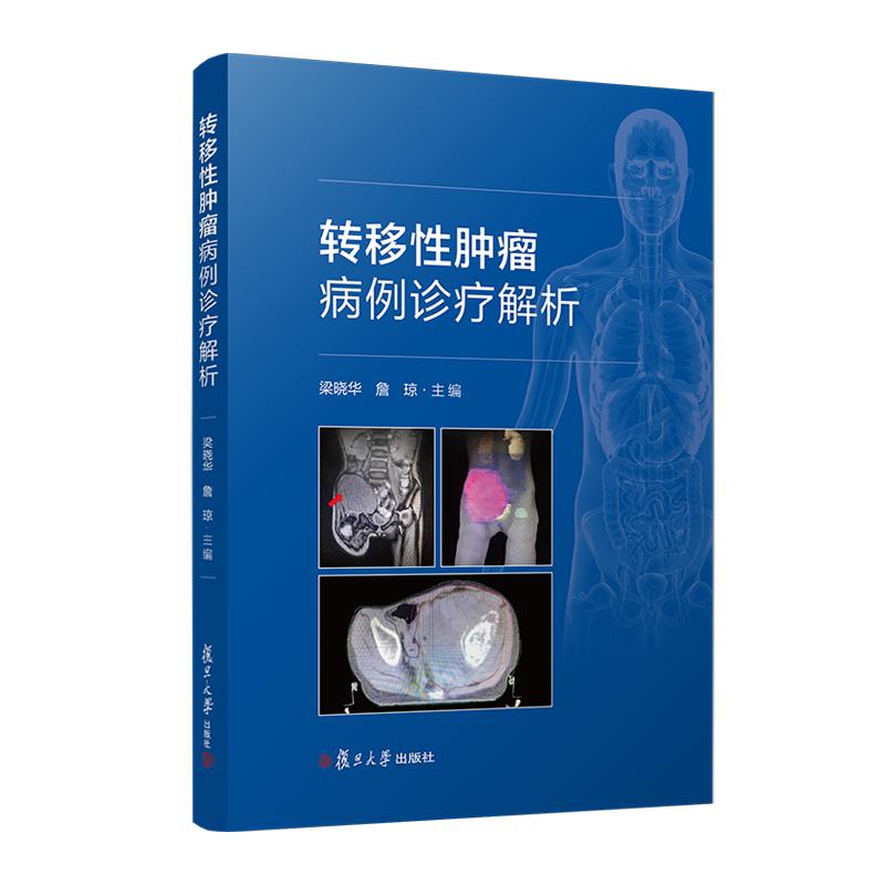 正版包邮 转移性肿瘤病例诊疗解析 梁晓华 詹琼 汇编了26个典型病例 病例突出循证医学的理念  复旦大学出版社 - 图0