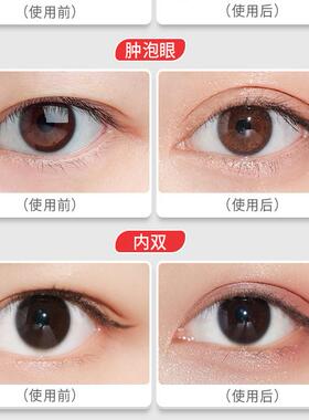 屈臣美目蕾丝双眼皮贴女无痕自然隐形粘性比较好内双肿眼泡男士