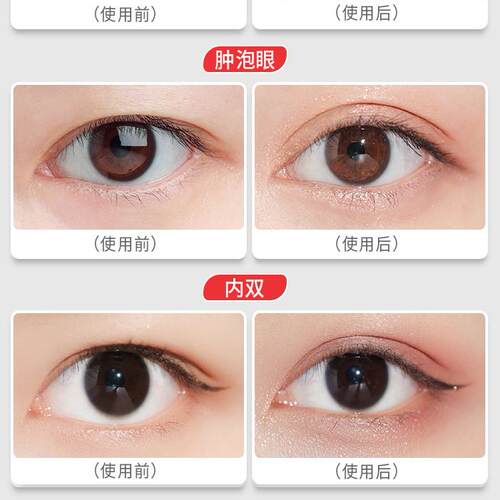 屈臣美目蕾丝双眼皮贴女无痕自然隐形粘性比较好内双肿眼泡男士 - 图1