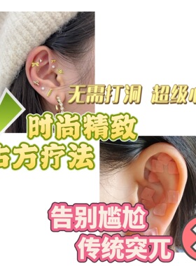 舍予物舍新款星星月亮耳钉女轻奢小众时尚耳穴贴耳钉（10贴装）