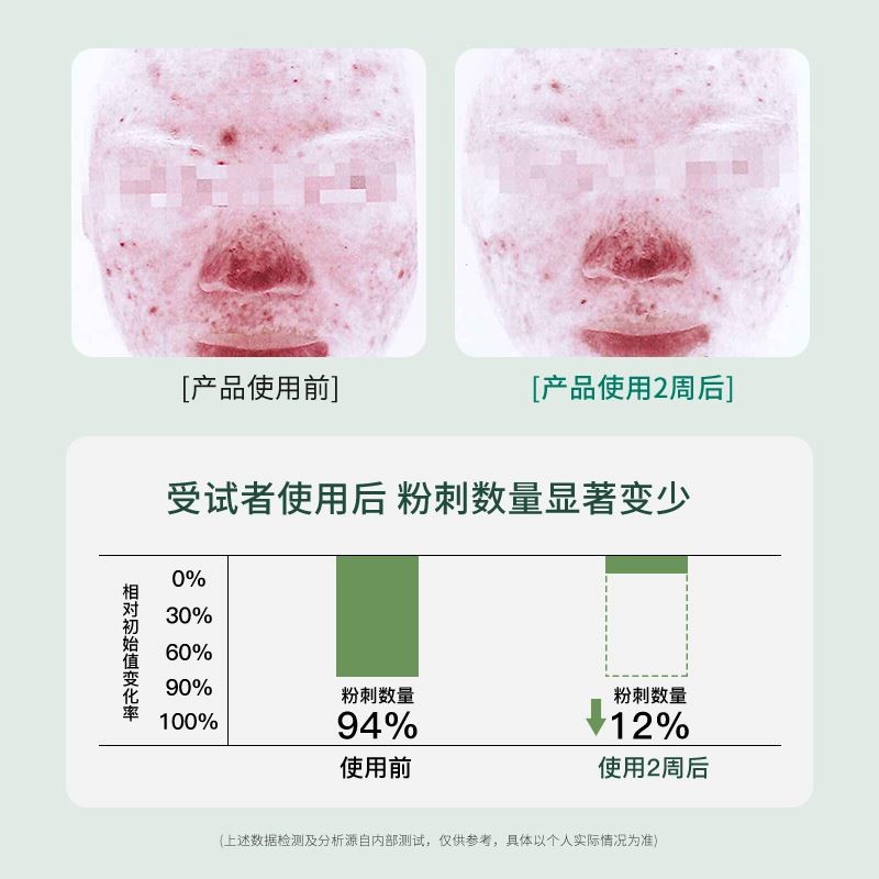 儿童洗面奶控油12岁以上青少年男孩女孩螨收缩毛孔专用