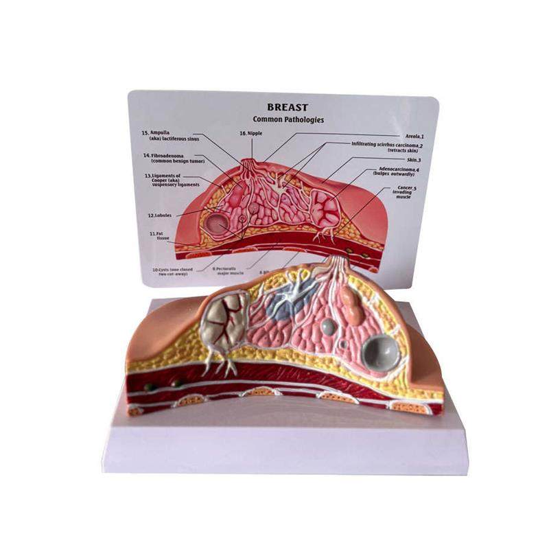 乳房模型乳腺增生家政培训妇产乳腺E演示哺乳期乳房构造催乳师教,淘宝优惠券,粉丝福利购,淘宝优惠卷