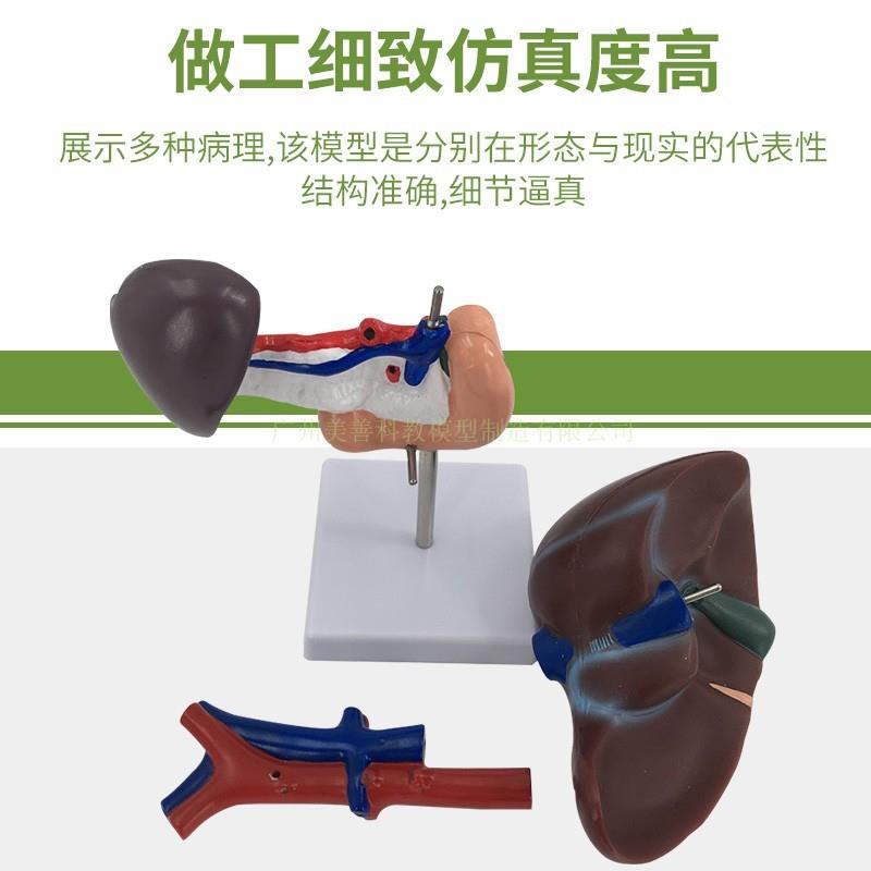 仿真人体肝脏模型肝解剖肝胆胰脾十二指肠病变肝胆U胰肝胆胰胃切 - 图2