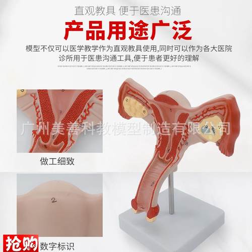 双侧卵巢子宫模型人体女性生殖子宫解剖阴M道卵巢教学妇科生殖科 - 图0