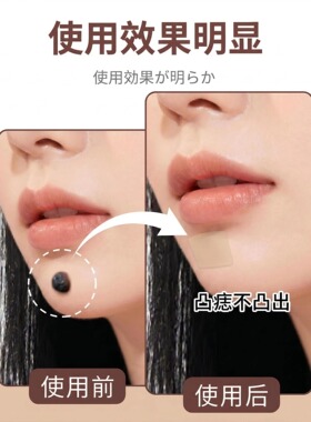 遮凸痣疤痕淡化防水凝胶贴