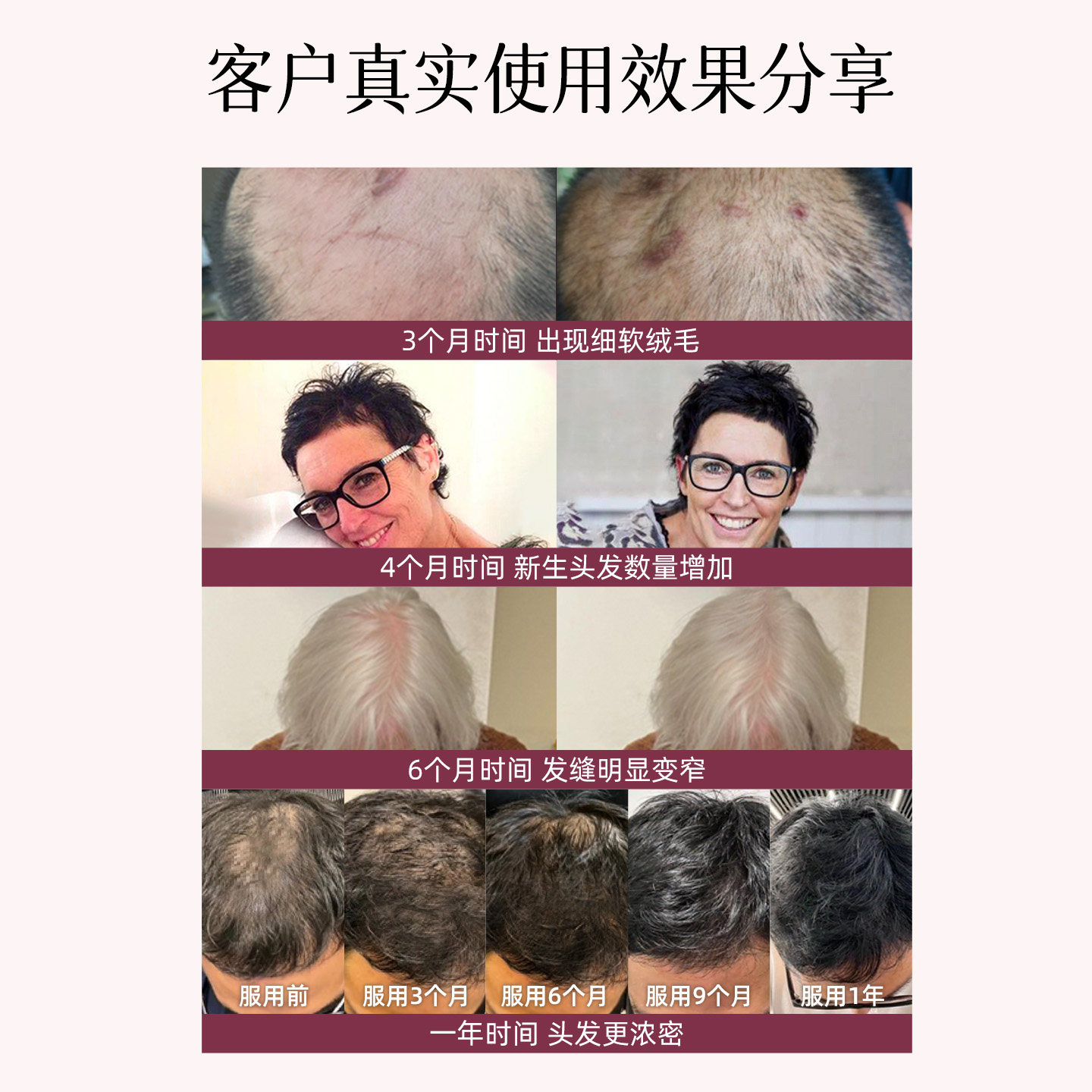 NewNordic护发片口服植物萃取高浓生物素滋补营养发根强韧柔顺