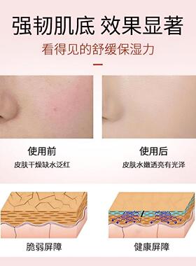 Avene/雅漾喷雾50ml任何肤质
