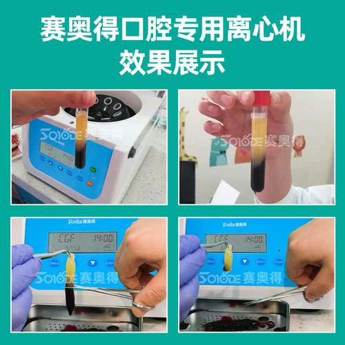 赛奥得牙科离心机CGF口腔专用种植器械促进伤口愈合牙骨创伤成骨 - 图2
