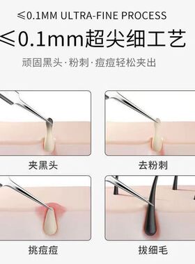 家用去黑头细胞夹子镊子粉刺针全套 美容专业不锈钢粉刺针4件套装