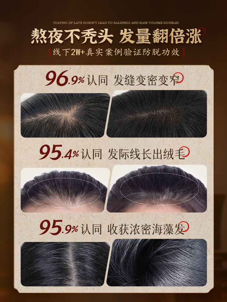 洗发水防脱生育固发中药增发密发控油蓬松男女士官方旗舰店非生姜 - 图0